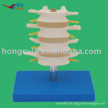 Vivid PVC Normal Lombar Model (4 pcs)